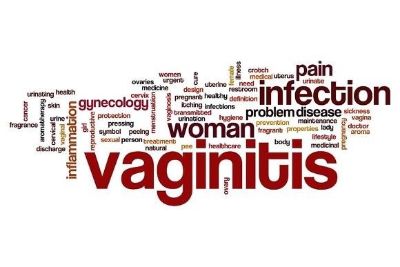 vaginitis-word-cloud